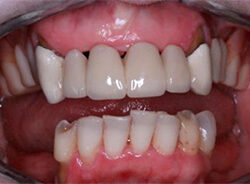 agnes before