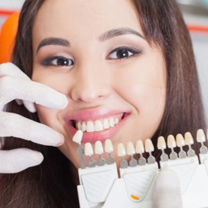 veneers process