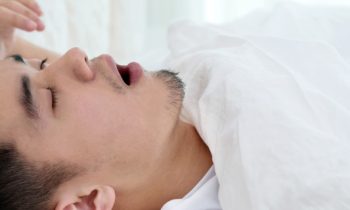 sleep apnea