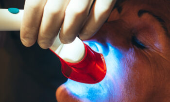 common cosmetic dental procedures
