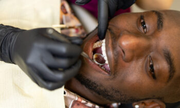 allergic to fillings