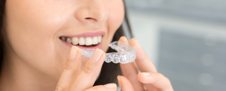 invisalign process