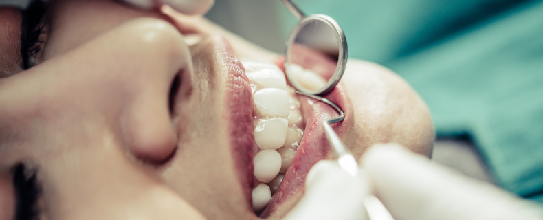 signs of gum disease