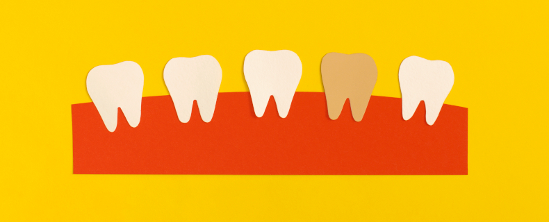 single dark tooth