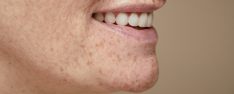 jaw study